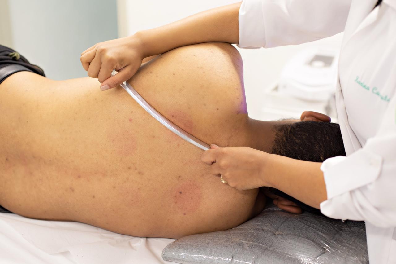 Fisioterapia e Acupuntura